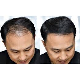 25g Keratin Hair Building Fibers for Thinning Hair by HitMyNeed
