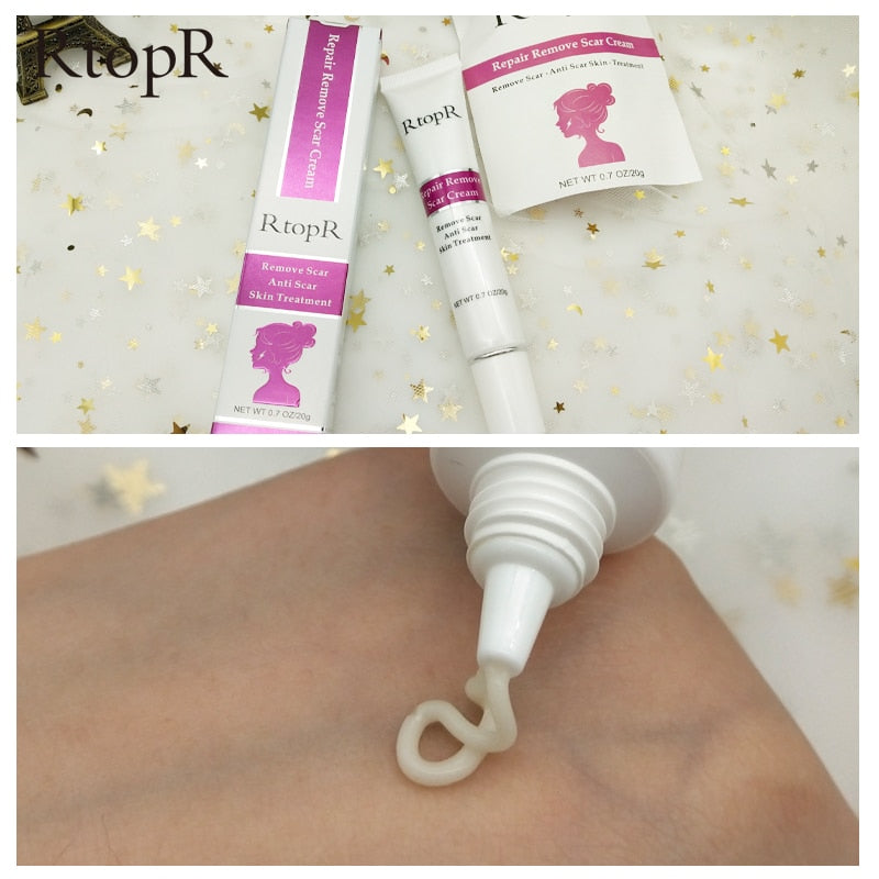 Acne Scar Cream for Dark Spots & Skin Repair 20g by HitMyNeed