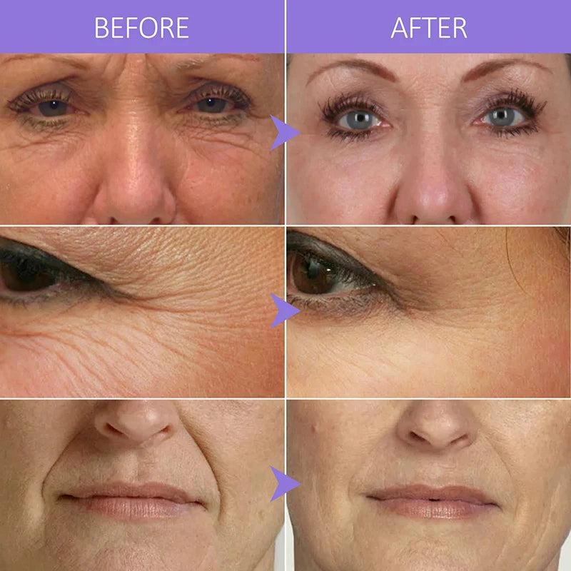 Collagen & Hyaluronic Acid Anti-Aging Face Serum by HitMyNeed