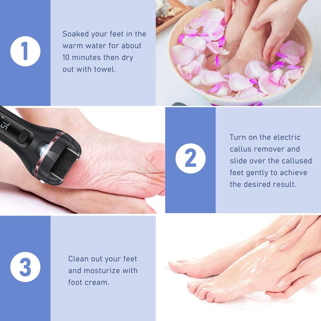 Electric Pedicure Foot Grinder Callus Remover by HitMyNeed