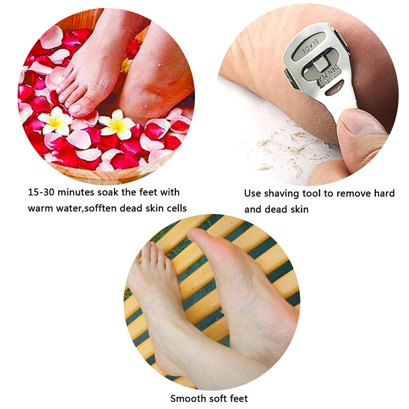 Foot Skin Shaver with 10 Replacement Blades by HitMyNeed