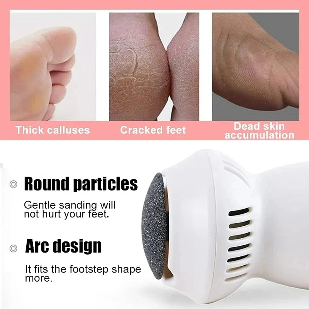 Rechargeable Electric Foot File & Callus Remover by HitMyNeed