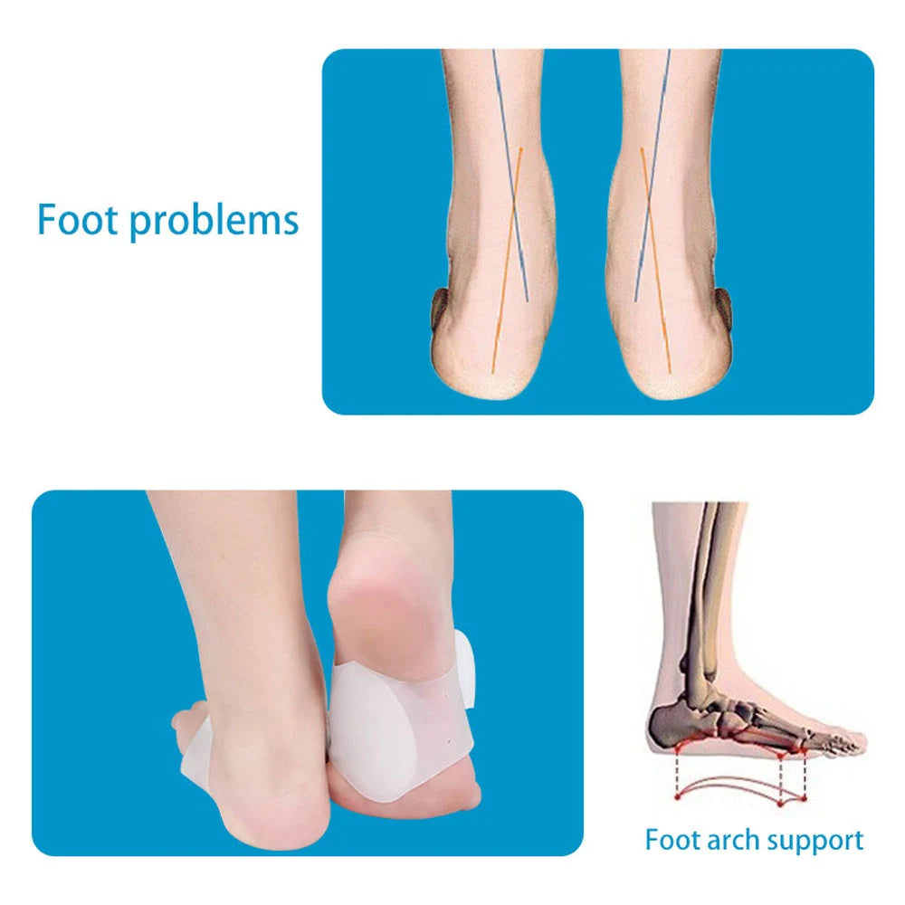 1 Pair Non-Slip Gel Arch Support Braces by HitMyNeed