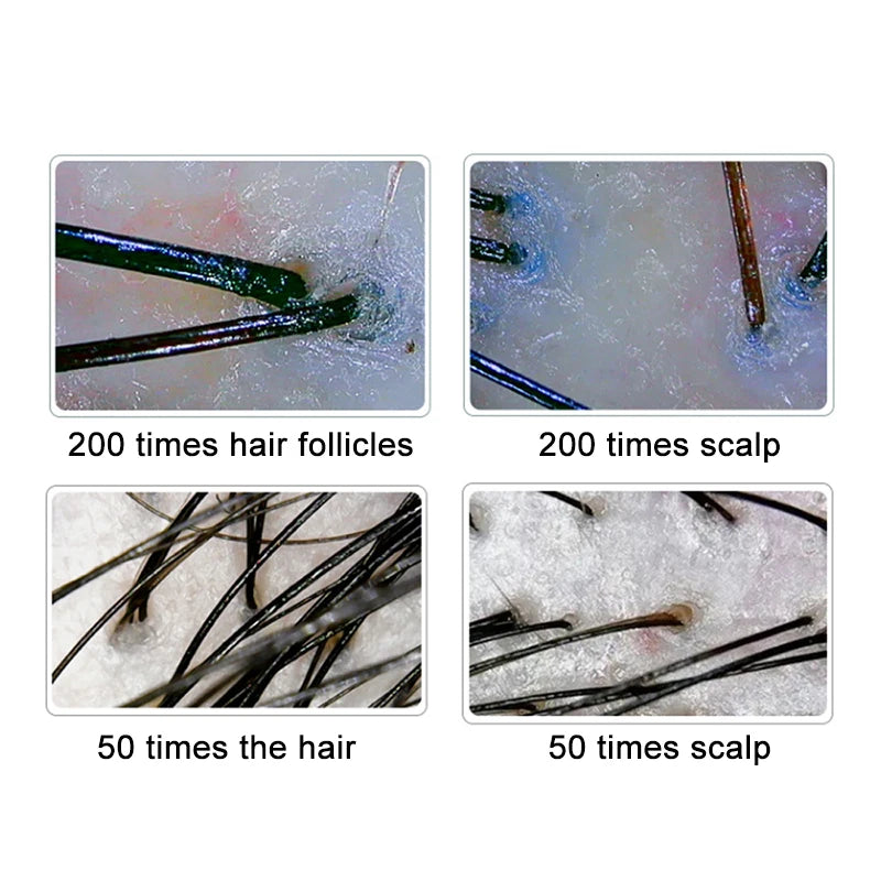 10" LCD Hair & Scalp Analyzer Microscope 50X/200X by HitMyNeed