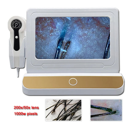 10" LCD Hair & Scalp Analyzer Microscope 50X/200X by HitMyNeed