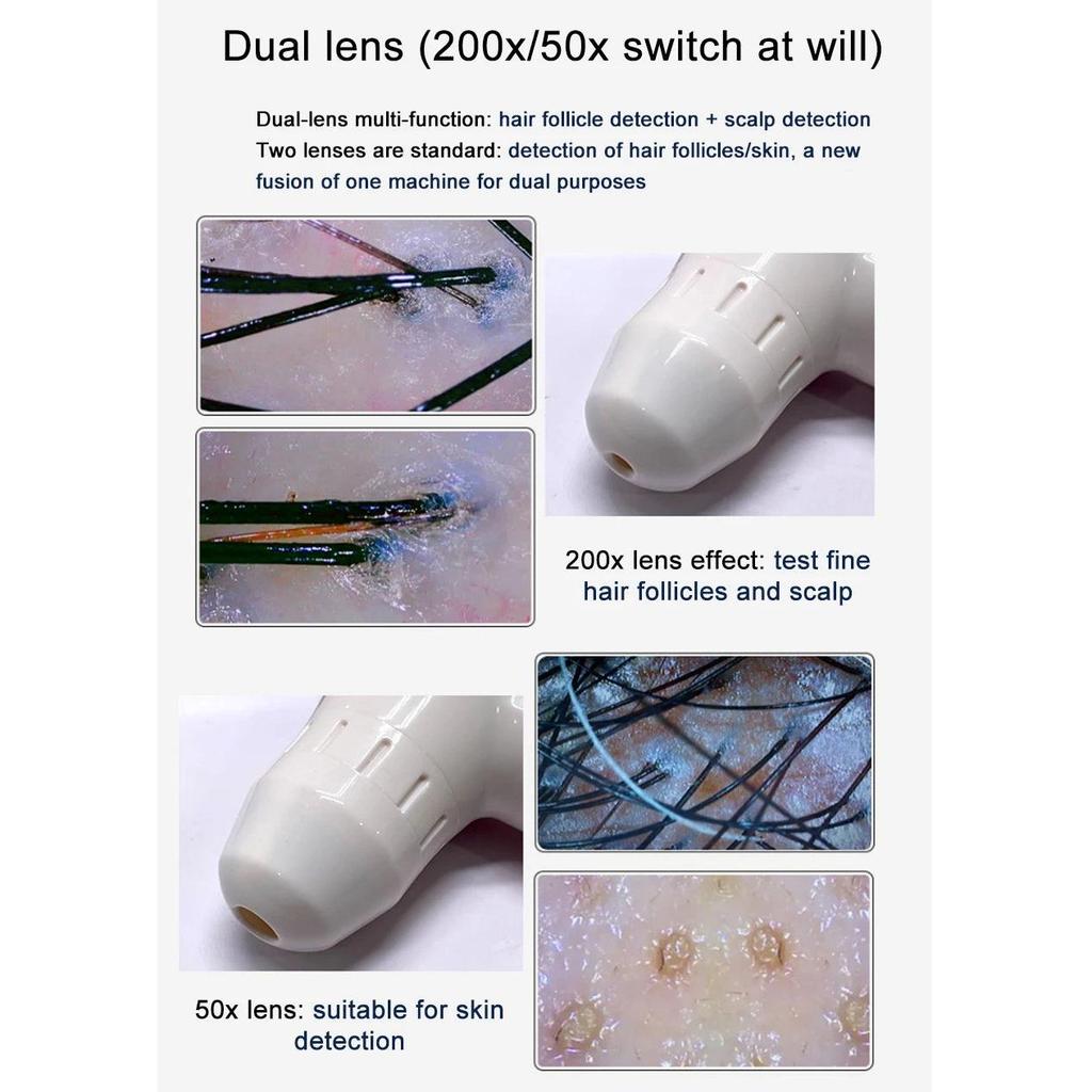 10" LCD Hair & Scalp Analyzer Microscope 50X/200X by HitMyNeed