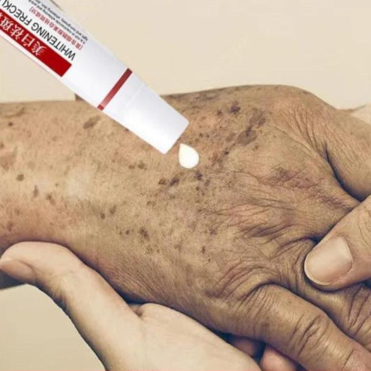 Melasma & Dark Spot Correcting Face Cream