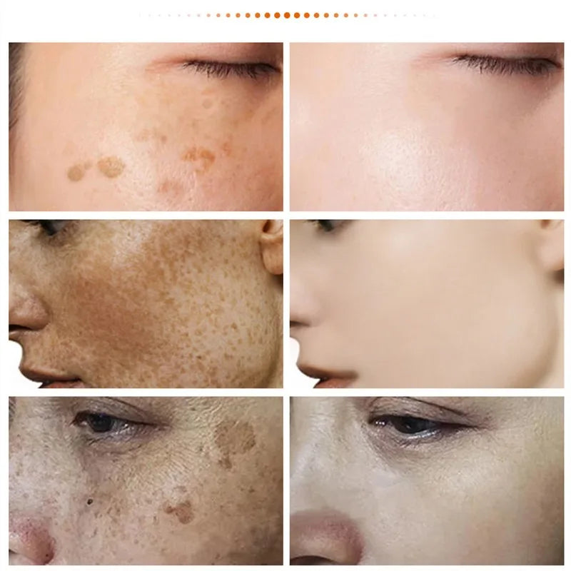 Melasma & Dark Spot Correcting Face Cream