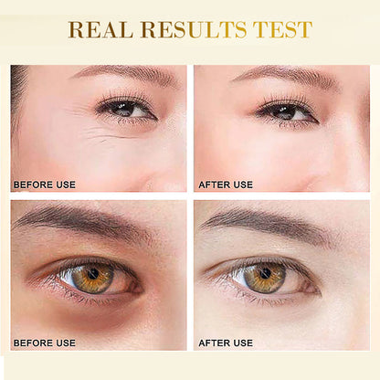24K Gold Hyaluronic Acid Collagen Eye Mask Patches by HitMyNeed