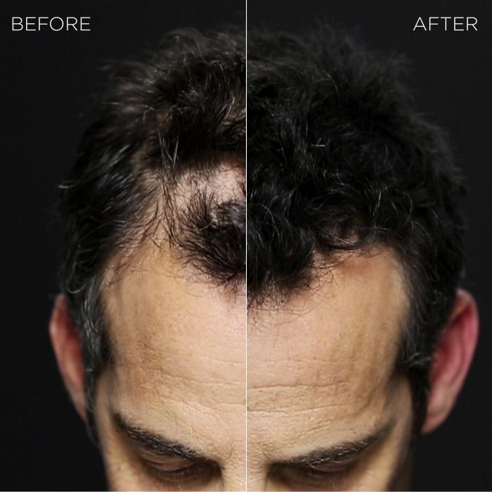 25g Keratin Hair Building Fibers for Thinning Hair by HitMyNeed