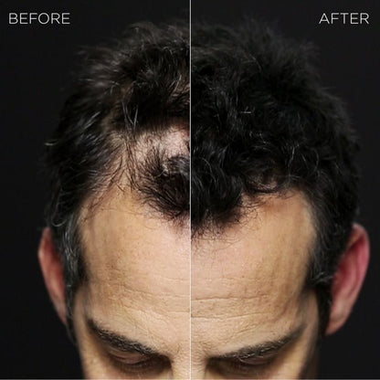 25g Keratin Hair Building Fibers for Thinning Hair by HitMyNeed