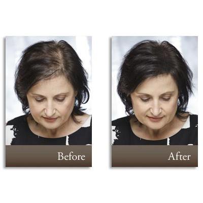 25g Keratin Hair Building Fibers for Thinning Hair by HitMyNeed