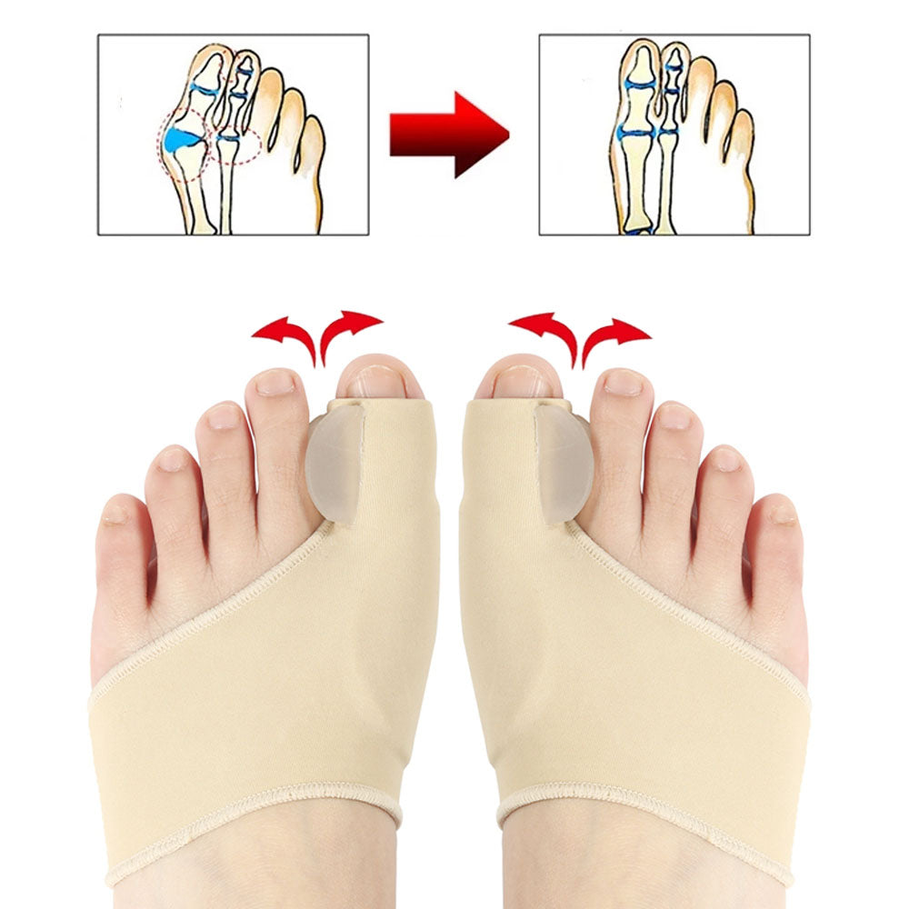 2pcs Hallux Valgus Toe Separator Bunion Corrector by HitMyNeed