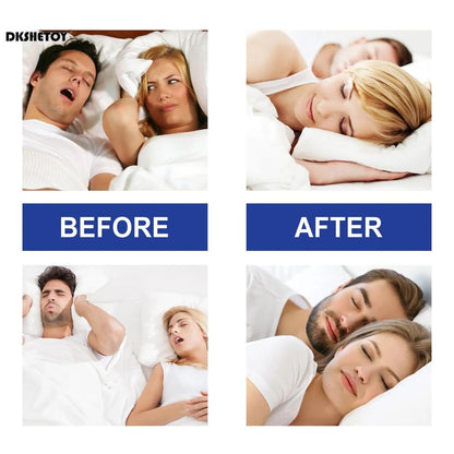30-Pack Anti Snoring Mouth Tape for Nasal Breathing by HitMyNeed