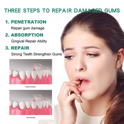 30ml Antibacterial Gum Care Mouth Rinse Concentrate by HitMyNeed
