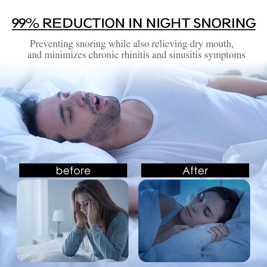 30pcs Anti-Snoring Mouth Tape for Better Night Breathing by HitMyNeed