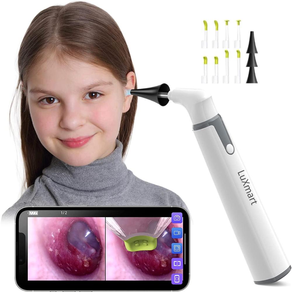 3.9mm Wireless Ear Camera Otoscope 720P HD by HitMyNeed