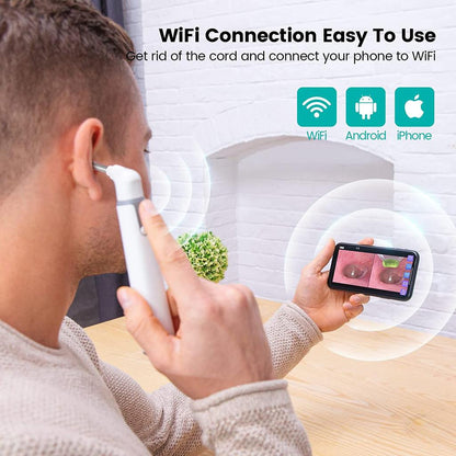3.9mm Wireless Ear Camera Otoscope 720P HD by HitMyNeed