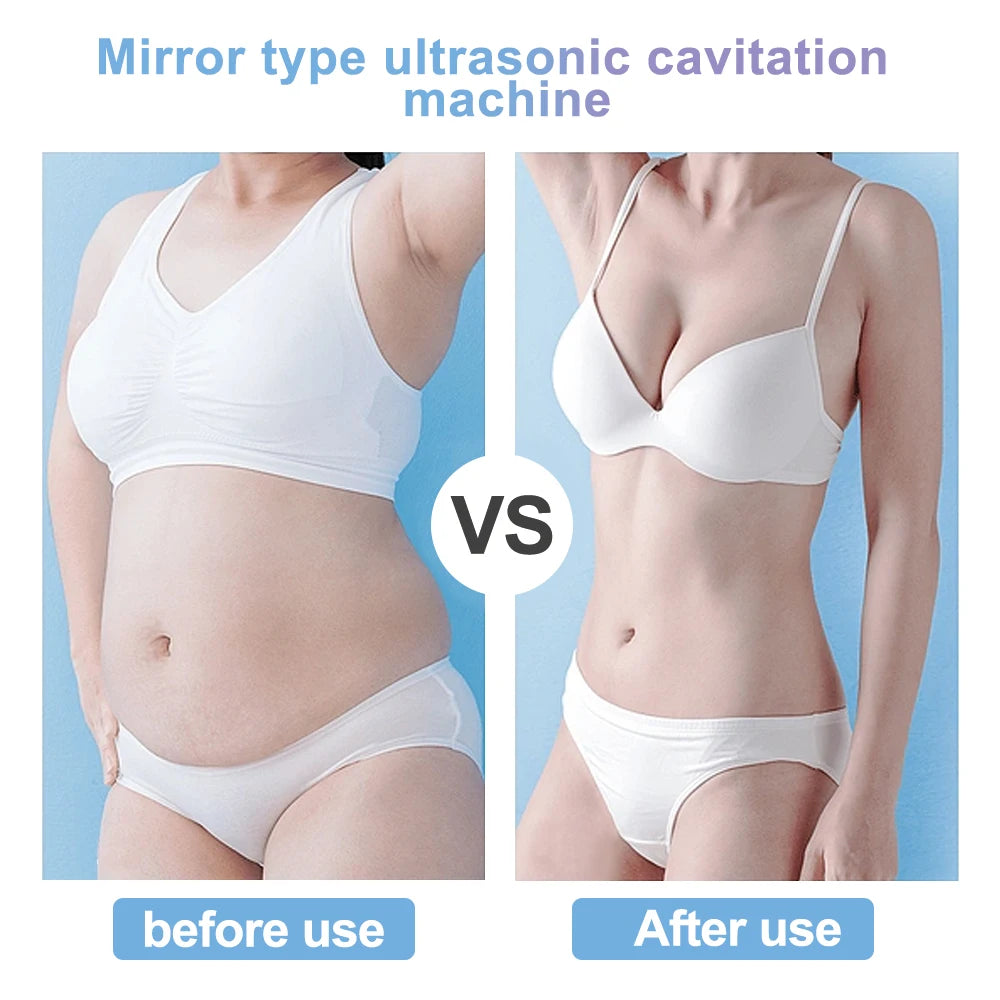 4-in-1 40K Cavitation & RF Facial and Body Device by HitMyNeed