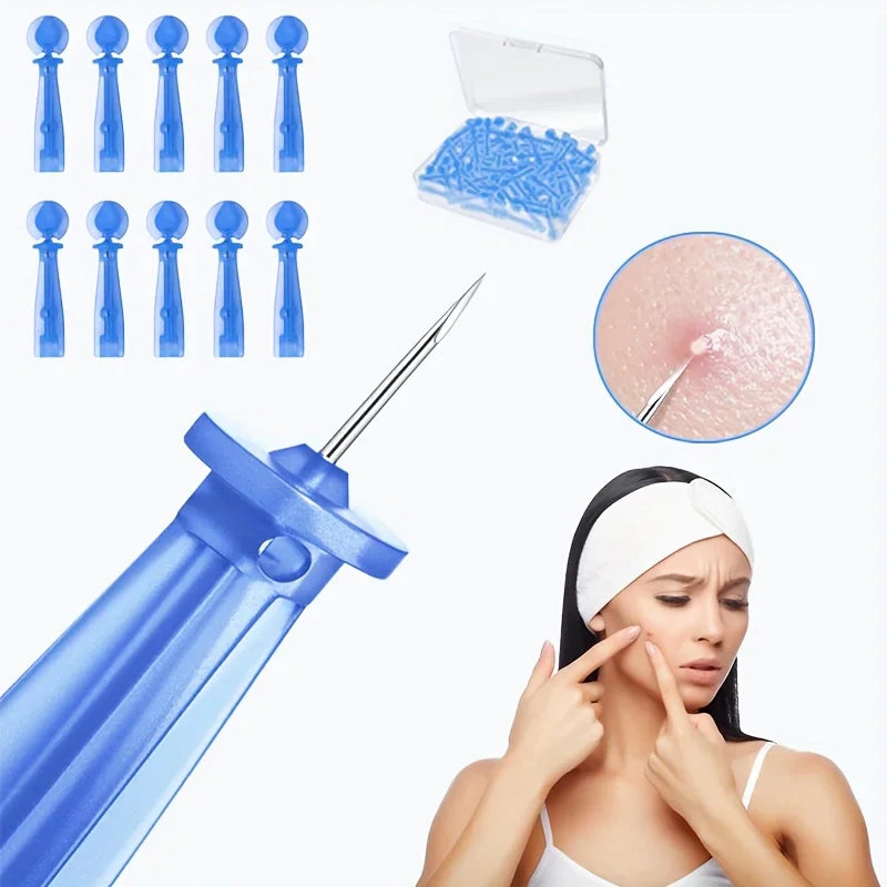 50pcs Disposable Stainless Steel Blackhead Remover Needles by HitMyNeed