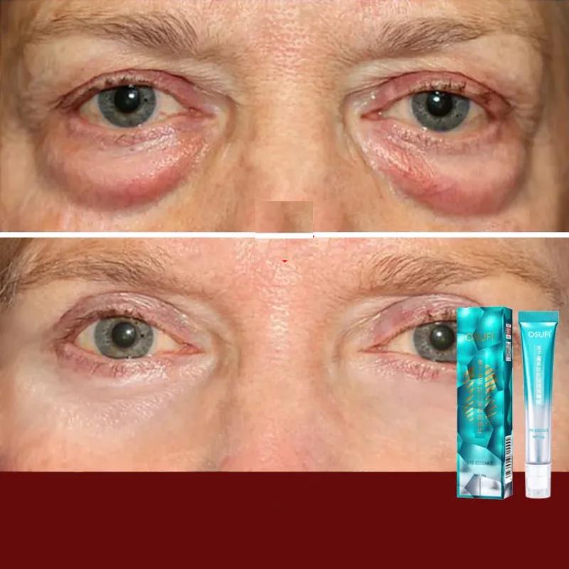 7-Day Anti-Wrinkle Eye Cream for Dark Circles by HitMyNeed