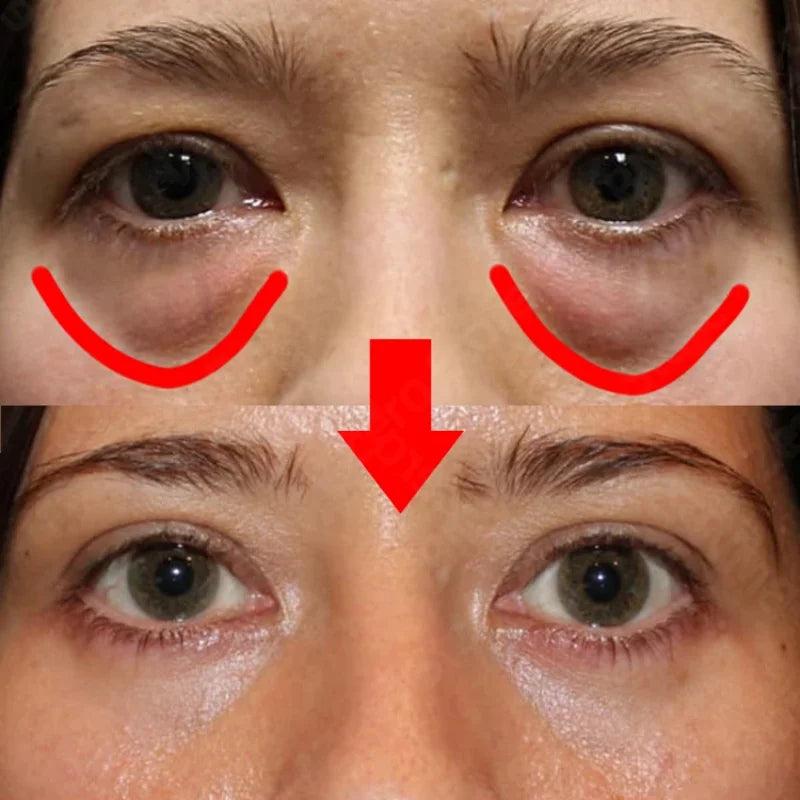 7-Day Anti-Wrinkle Eye Cream for Dark Circles by HitMyNeed