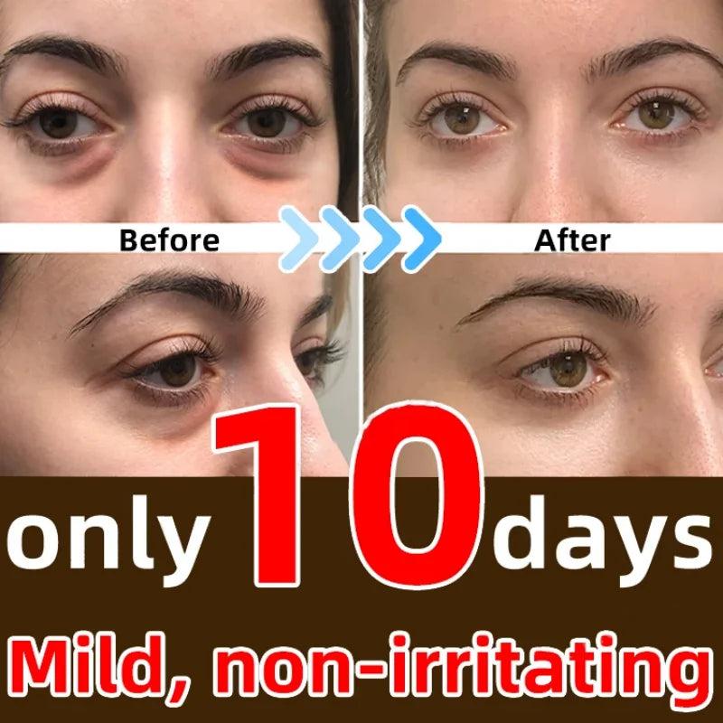 7-Day Anti-Wrinkle Eye Cream for Dark Circles by HitMyNeed