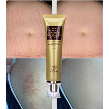 Acne and Scar Removal Cream for Clearer Skin by HitMyNeed