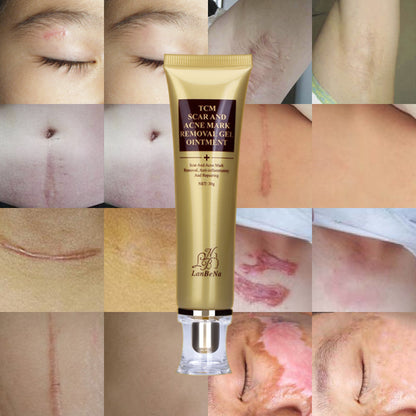 Acne and Scar Removal Cream for Clearer Skin by HitMyNeed
