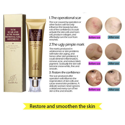 Acne and Scar Removal Cream for Clearer Skin by HitMyNeed