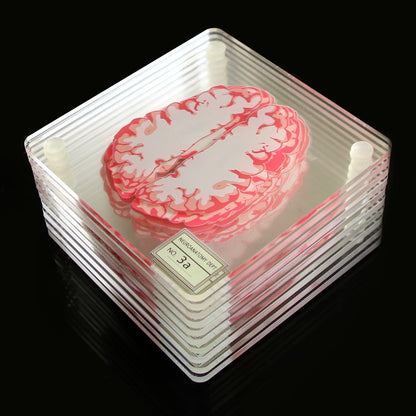 Acrylic Non-Slip Brain Coasters Set of 10 by HitMyNeed