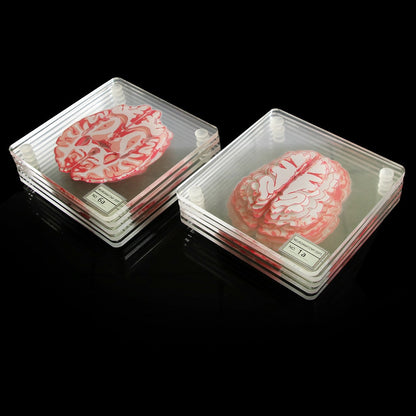 Acrylic Non-Slip Brain Coasters Set of 10 by HitMyNeed