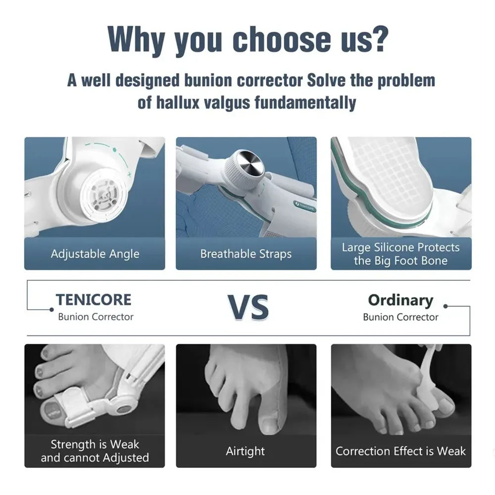 Adjustable Bunion Corrector with 3-Angle Hallux Valgus Support by HitMyNeed