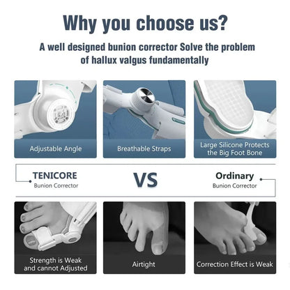 Adjustable Bunion Corrector with 3-Angle Hallux Valgus Support by HitMyNeed