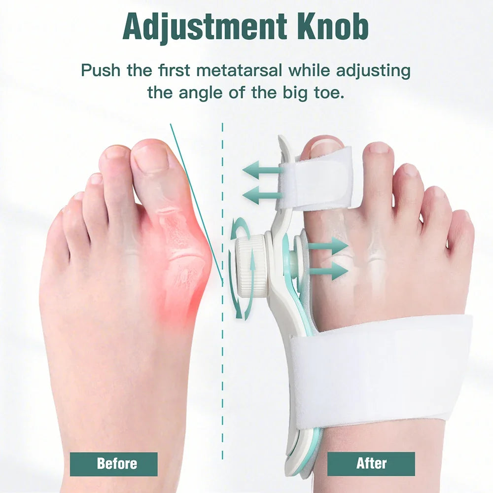 Adjustable Bunion Corrector with 3-Angle Hallux Valgus Support by HitMyNeed