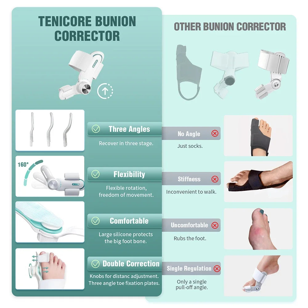 Adjustable Bunion Corrector with 3-Angle Hallux Valgus Support by HitMyNeed