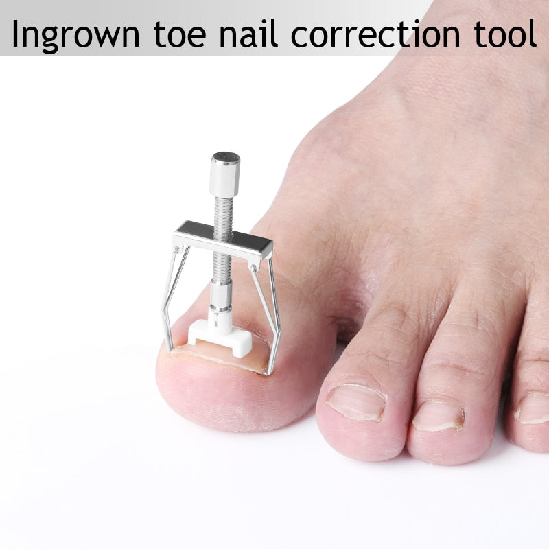 Adjustable Ingrown Toenail Corrector Tool Set by HitMyNeed