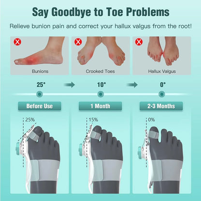 Adjustable Rotating Bunion Corrector for Hallux Valgus by HitMyNeed