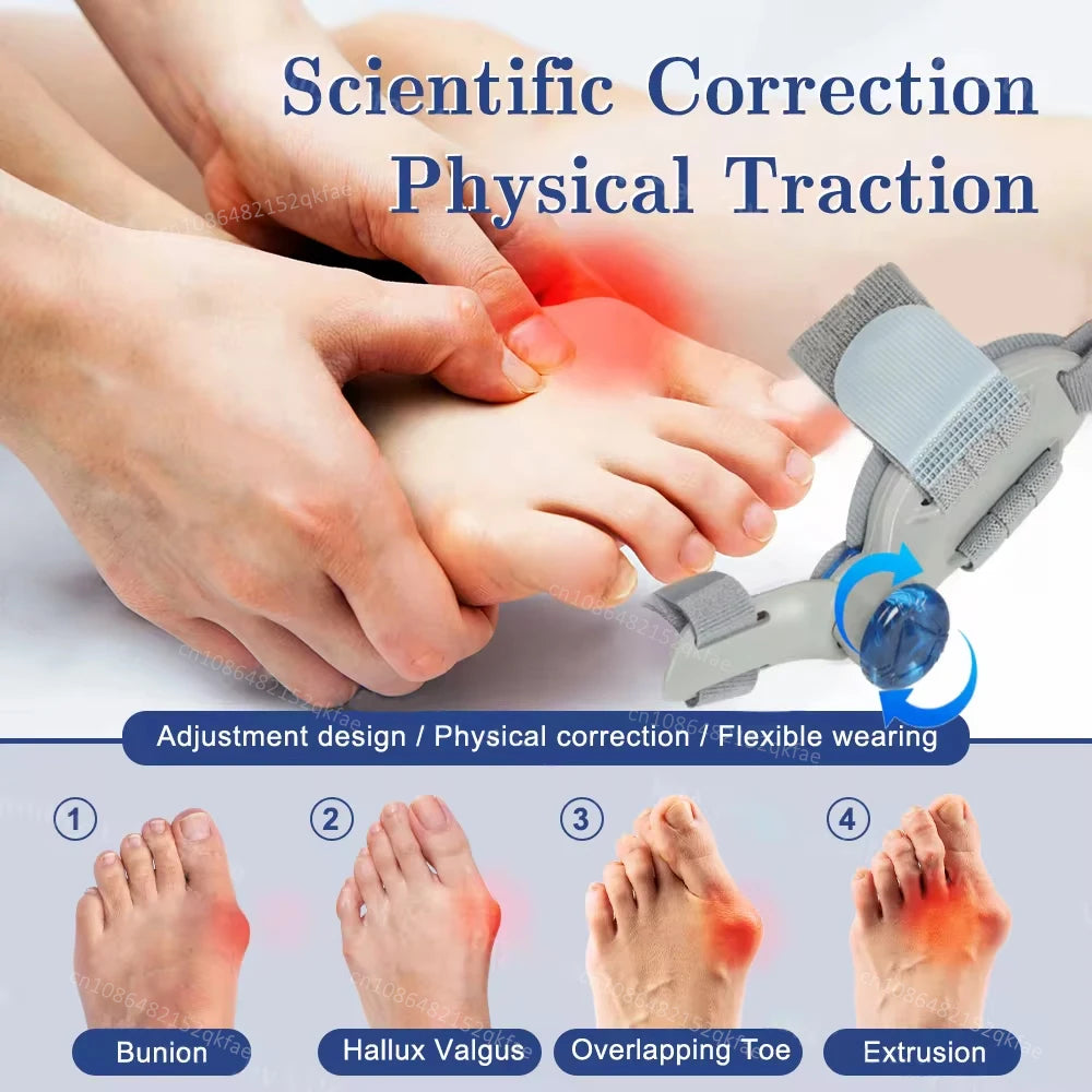 Adjustable Rotating Bunion Corrector for Hallux Valgus by HitMyNeed