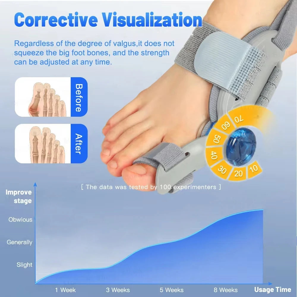 Adjustable Rotating Bunion Corrector for Hallux Valgus by HitMyNeed