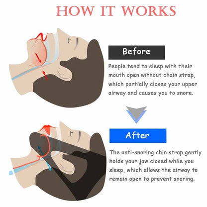 Adjustable Snoring Chin Strap Jaw Support by HitMyNeed