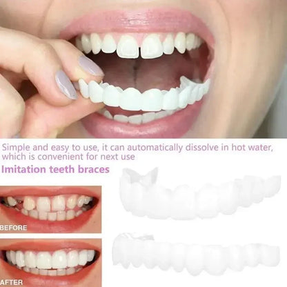 Adult Adjustable Snap-On Dentures Veneer Set by HitMyNeed