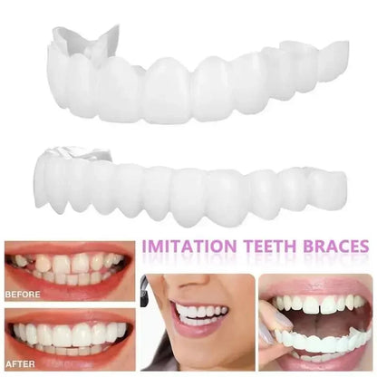 Adult Adjustable Snap-On Dentures Veneer Set by HitMyNeed
