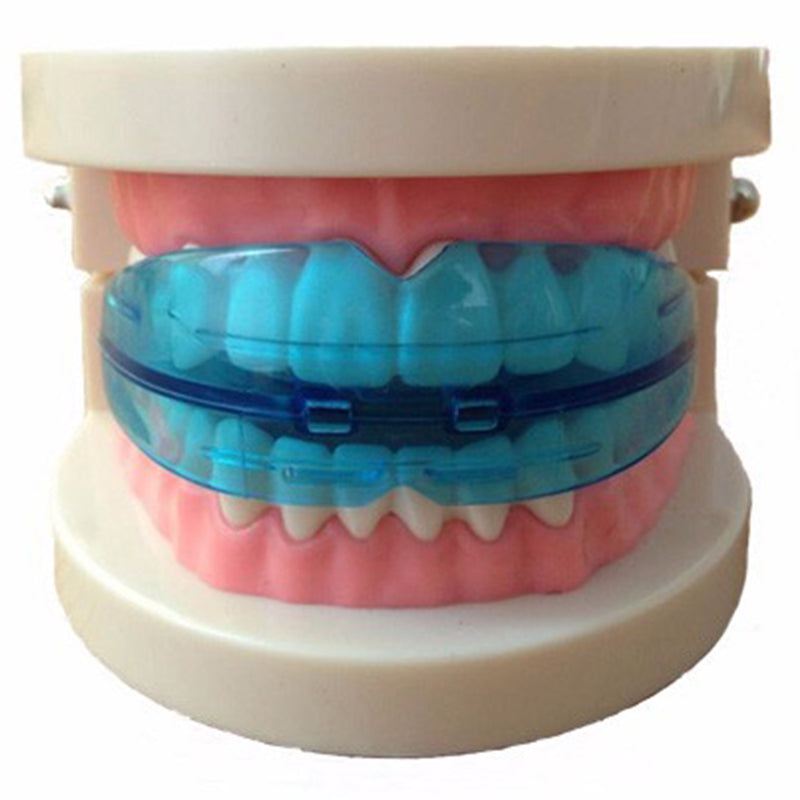 Adult Orthodontic Teeth Alignment Trainer by HitMyNeed
