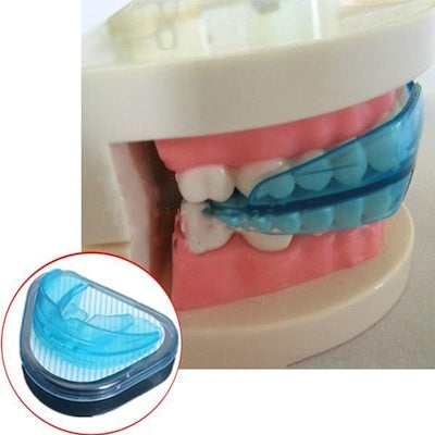 Adult Orthodontic Teeth Alignment Trainer by HitMyNeed