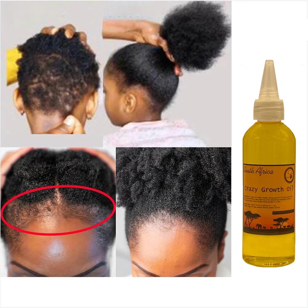 Africa Chebe Hair Growth Oil for Breakage & Loss 50ml by HitMyNeed