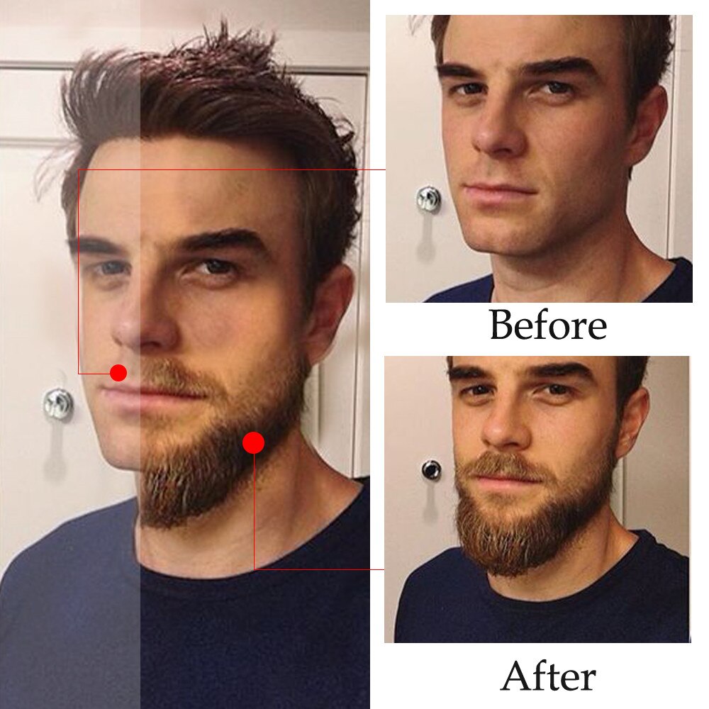 All Natural Beard Growth Oil 30ml by HitMyNeed