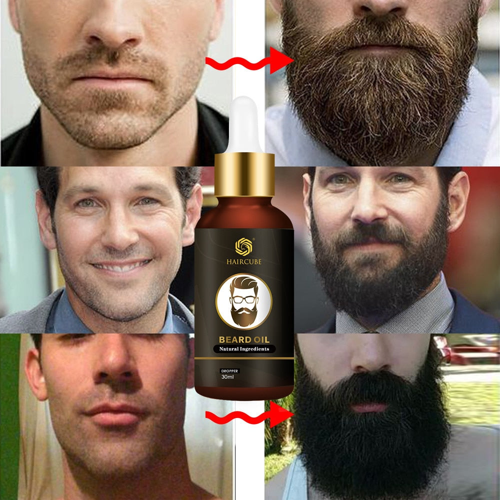 All Natural Beard Growth Oil 30ml by HitMyNeed
