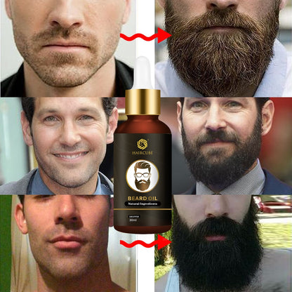 All Natural Beard Growth Oil 30ml by HitMyNeed