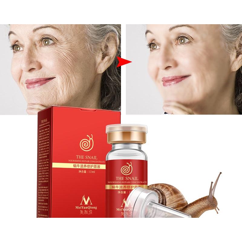 Anti-Acne Snail Repair Serum 12ml by HitMyNeed